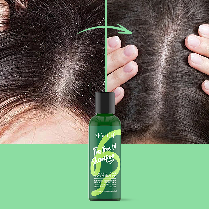 Tea Tree Essence Shampoo Hair  - Hair Care Set ulasan dan harga