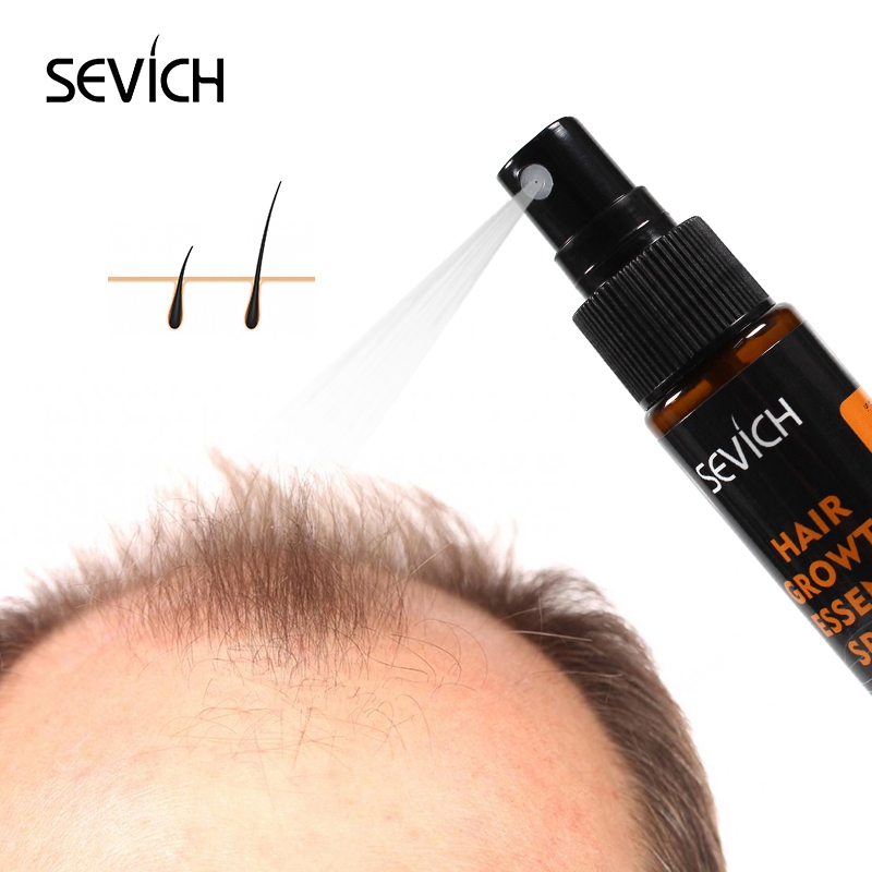 Sevich 30ml Hebal Oil Essence  - Hair Care Herbal ulasan dan harga