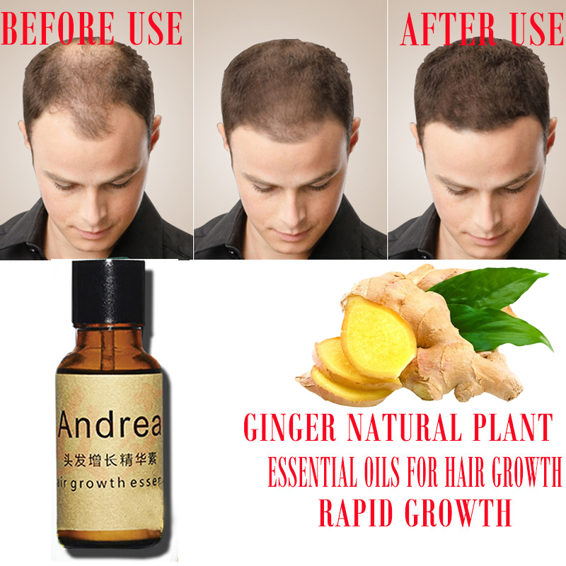 2/5/10Pcs Andrea Hair Growth S - Hair Care Herbal ulasan dan harga
