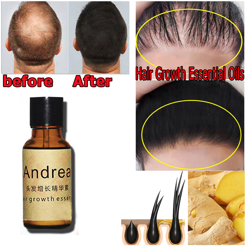 2/5/10Pcs Andrea Hair Growth S - Hair Care Herbal ulasan dan harga